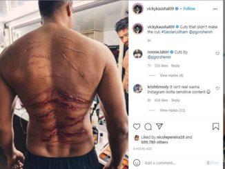 Vicky Kaushal Shows Scars on Back from 'Sardar Udham'